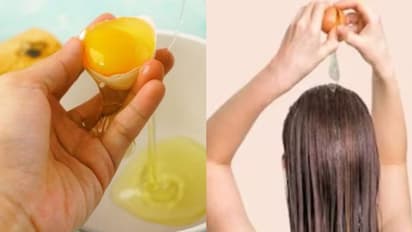 തലമുടി കൊഴിച്ചില് അകറ്റാനും തഴച്ചുവളരാനും മുട്ട ഇങ്ങനെ ഉപയോഗിക്കാം...