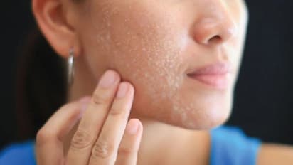 വരണ്ട ചര്‍മ്മത്തിന് വിട; സ്കിന്‍ ഈർപ്പമുള്ളതാക്കാൻ കഴിക്കാം ഈ പത്ത് ഭക്ഷണങ്ങള്‍... 