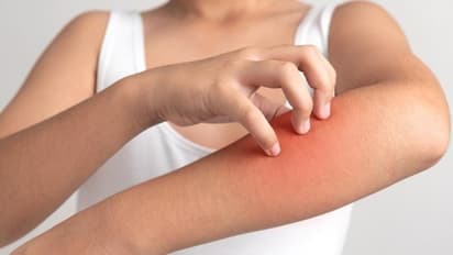 നിങ്ങള്‍ക്ക് പാലിനോട് അലര്‍ജിയുണ്ടോ? ; ഇത് മനസിലാക്കാൻ ചെയ്യാവുന്നത്...