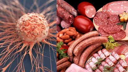 നിങ്ങള് പതിവായി കഴിക്കുന്ന ഈ അഞ്ച് ഭക്ഷണങ്ങള് ക്യാൻസര് സാധ്യതയെ കൂട്ടും...