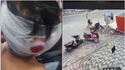 വീട്ടുമുറ്റത്ത് കളിക്കുകയായിരുന്ന പിഞ്ചുകുഞ്ഞിനെ തെരുവുനായ ക്രൂരമായി ആക്രമിച്ചു, മറ്റ് 3 പേർക്കും കടിയേറ്റു