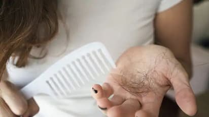 ഈ ഏഴ് ഭക്ഷണങ്ങൾ തലമുടി കൊഴിച്ചിലിന് കാരണമാകും...