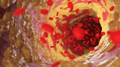 Health Tips: കൊളസ്ട്രോള് കുറയ്ക്കാന് പതിവായി കഴിക്കാം ഈ എട്ട് ഭക്ഷണങ്ങള്...