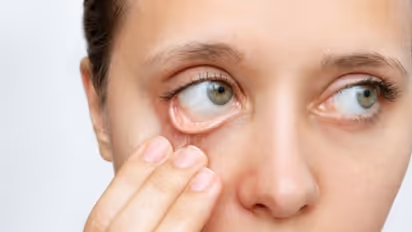 അയേണിന്റെ കുറവുണ്ടോ? ദിവസവും കഴിക്കാം ഈ ഒരൊറ്റ ഫ്രൂട്ട്...