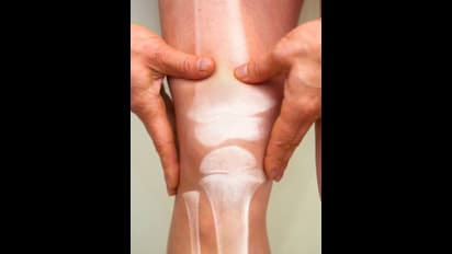 Tips for preventing sports-related injuries; know from experts