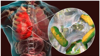 ശ്രദ്ധിക്കൂ, ഈ ഭക്ഷണങ്ങൾ കരളിനെ തകരാറിലാക്കും