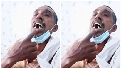 ഉത്സവത്തിനിടെ എസ്.ഐ 56 കാരന്റെ പല്ലടിച്ചു കൊഴിച്ചു; മറ്റു പല്ലുകൾ ഇളകി, പരാതി