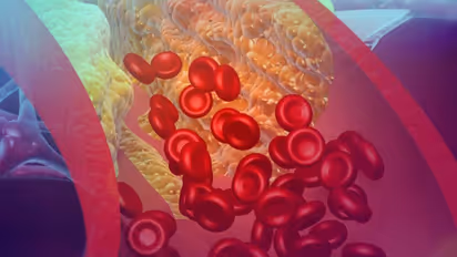 കൊളസ്ട്രോള് കുറയ്ക്കണോ? ചെയ്യേണ്ട ആറ് കാര്യങ്ങള്...