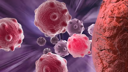 ശ്രദ്ധിക്കൂ, ഈ ആറ് ശീലങ്ങൾ ക്യാൻസറിന് കാരണമാകാം... 