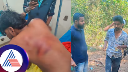 ಸಂಬಳ ಕೇಳಿದ್ದಕ್ಕೆ ಕಾರ್ಮಿಕನಿಗೆ ಮನಬಂದಂತೆ ಥಳಿಸಿ ವಿಕೃತಿ ಮೆರೆದ ಹೋಟೆಲ್ ಮಾಲೀಕ!