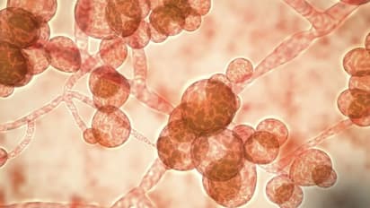 മനുഷ്യരില്‍ നിന്ന് മനുഷ്യരിലേക്ക് പകരുന്ന അപകടകാരിയായ 'കാൻഡിഡ ഓറിസ്' ഫംഗസ് കേസുകള്‍...