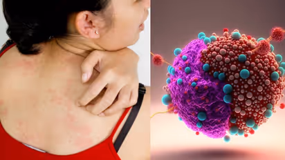 ആദ്യ ഘട്ടത്തില് തിരിച്ചറിയാന് കഴിയാത്ത ആറ് ക്യാന്സറുകള്; അറിയാം ഈ പ്രാരംഭ ലക്ഷണങ്ങൾ...