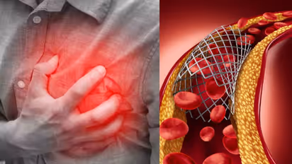 ഈ മത്സ്യം പതിവാക്കൂ, ഉയര്ന്ന കൊളസ്ട്രോളിനെ കുറയ്ക്കാം...