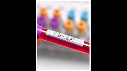 గుడ్ న్యూస్ : ప్రాణాంతక క్యాన్సర్ కు మందు కనిపెట్టిన లండన్ శాస్త్రవేత్తలు...