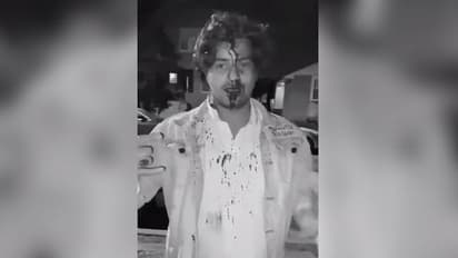 ப்ளீஸ் காப்பாத்துங்க... அமெரிக்காவில் முகத்தில் வழியும் ரத்தத்துடன் உதவி கேட்கும் இந்திய மாணவர்!