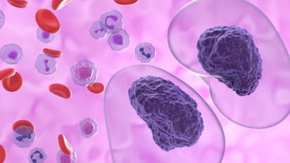 ക്യാൻസർ കേസുകള്‍ വർദ്ധിച്ചുവരുന്നതിന് പിന്നിലെ ആറ് കാരണങ്ങള്‍...