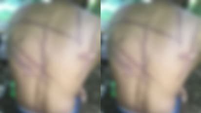  തീക്കനൽ വാരിയിട്ട് രഹസ്യഭാഗത്ത് പൊള്ളിച്ചു; കാപ്പ കേസ് പ്രതിയെ മൃ​ഗീയമായി കൊല്ലാൻ ശ്രമിച്ച പ്രതികൾ അറസ്റ്റിൽ