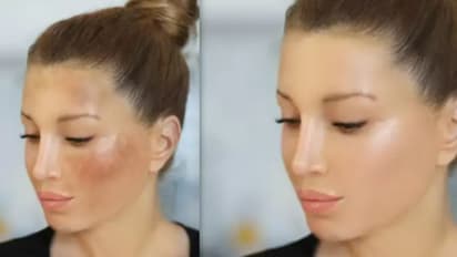 മുഖത്തെ കറുത്ത പാടുകള് അകറ്റണോ? പതിവായി ഉപയോഗിക്കേണ്ട ആറ് ഫേസ് പാക്കുകള്...