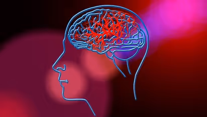 സ്ട്രോക്ക് അഥവാ പക്ഷാഘാതത്തിന്റെ സാധ്യതയെ തടയാന് കഴിക്കാം ഈ ഭക്ഷണങ്ങള്...