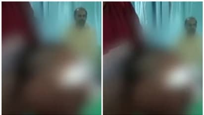 തെരുവുനായയുടെ കടിയേറ്റ് മൂന്നരവയസ്സുകാരന് മുഖത്ത് ഗുരുതര പരിക്ക്