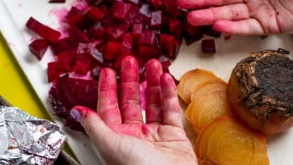 പാചകം കഴിയുമ്പോള് കൈ ഇങ്ങനെയാകുന്നോ? കൈകള് തിളങ്ങുന്നതാക്കാൻ മാര്ഗമുണ്ട്...