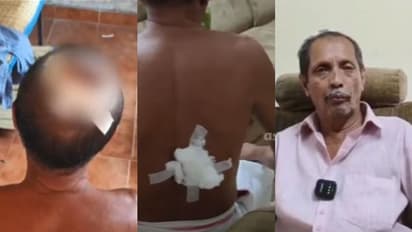 'ഉച്ചത്തിൽ കൊട്ടെടാ'; പഞ്ചവാദ്യത്തിന് ശബ്ദം പോര, കൊല്ലത്ത് ക്ഷേത്ര ജീവനക്കാരനെ തോർത്തിൽ കല്ല് കെട്ടി തല്ലി