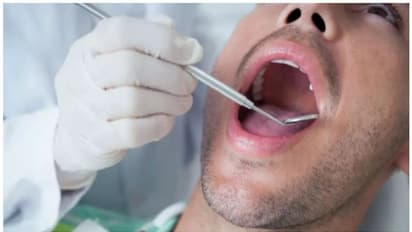 വായിലെ ക്യാൻസർ ; ഈ അഞ്ച് ലക്ഷണങ്ങൾ അവഗണിക്കരുത്