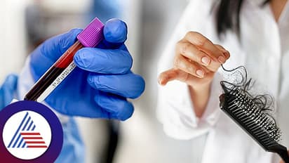 ವಿಪರೀತ ಕೂದಲುದುರ್ತಿದ್ರೆ ಚಿಕಿತ್ಸೆ ಮುನ್ನ ಈ ಬ್ಲಡ್ ಟೆಸ್ಟ್ ಮಾಡಿಸಿ!