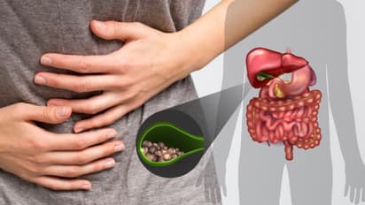 പിത്താശയക്കല്ല് തടയാന് ഡയറ്റില് ഉള്പ്പെടുത്താം ഈ ഭക്ഷണങ്ങള്...