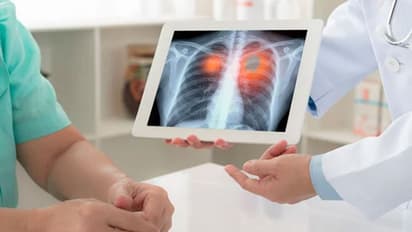 ಕೋವಿಡ್ ಸೋಂಕಿನ ನಂತರ ಭಾರತೀಯರಲ್ಲಿ ಹೆಚ್ತಿದೆ ಶ್ವಾಸಕೋಶದ ಸಮಸ್ಯೆ; ಅಧ್ಯಯನ