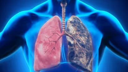 ശ്വാസകോശത്തിലെ വിഷാംശങ്ങൾ നീക്കം ചെയ്ത് ആരോഗ്യമേകാൻ സഹായിക്കും ഈ 10 ഭക്ഷണങ്ങള്...