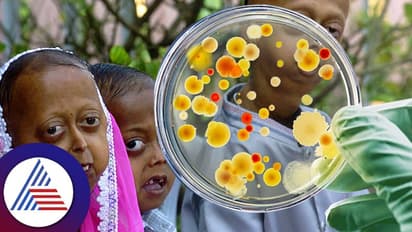 ಜಗತ್ತಿನಲ್ಲಿ ಎಂಥೆಂಥ ಚಿತ್ರ ವಿಚಿತ್ರ ಕಾಯಿಲೆಗಳು ಇವೆ ಗೊತ್ತಾ?