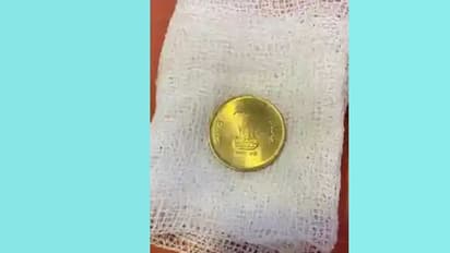 കളിക്കുന്നതിനിടെ ഏഴു വയസ്സുകാരൻ വിഴുങ്ങിയത് അഞ്ചു രൂപ നാണയം: പുറത്തെടുത്തത് ഇങ്ങനെ...