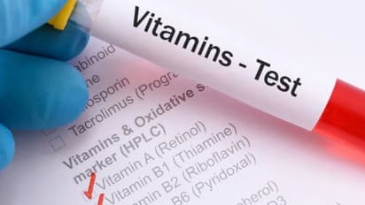 നിങ്ങള്‍ വൈറ്റമിൻ ടെസ്റ്റ് ചെയ്തിട്ടേ ഇല്ലേ? എങ്കില്‍ അറിയേണ്ടത്...