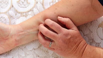 ഈ എട്ട് ലക്ഷണങ്ങളെ അവഗണിക്കരുത്, വൃക്കരോഗത്തിന്റെയാകാം...