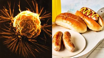 ക്യാൻസര് സാധ്യത കൂട്ടുന്ന ഈ നാല് തരം ഭക്ഷണങ്ങളെ അറിയാതെ പോകരുതേ...