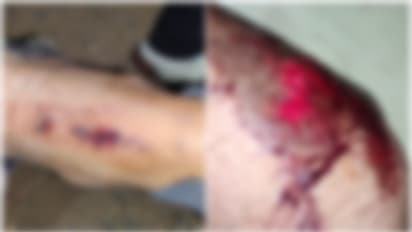 പേടിച്ച് പുറത്തിറങ്ങാനാവില്ല! കാട്ടുപന്നിക്കൂട്ടം ഒന്നാകെ ബൈക്കിന് കുറുകെ ചാടി; വീഴ്ചയിൽ യുവാവിന് പരിക്ക്