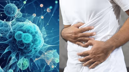 What are the causes and symptoms of stomach cancer? Early diagnosis can help with the cure