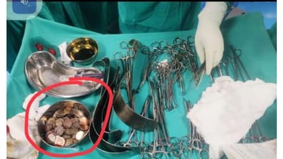 New Delhi News: दिल्ली के 26 वर्षीय युवक ने निगल लिए 37 चुंबक, 39 सिक्के, वजह जान डाक्टर भी रह गए हैरान