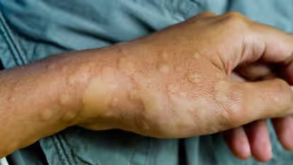 ചര്മ്മത്ത് കാണുന്ന ഇത്തരം മാറ്റങ്ങളെ ശ്രദ്ധിക്കാതെ പോകരുത്, കാരണമിതാകാം...