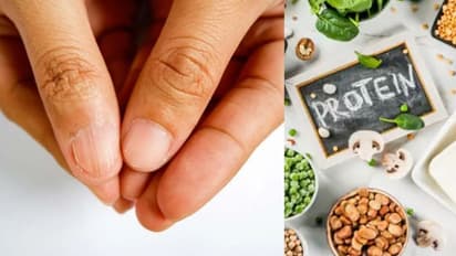 പ്രോട്ടീന്‍ അടങ്ങിയ ഭക്ഷണങ്ങള്‍ കഴിക്കണമെന്ന് പറയുന്നതിന്‍റെ കാരണങ്ങള്‍... 