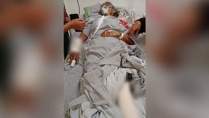 വീട്ടുമുറ്റത്ത് ജോലി ചെയ്തുകൊണ്ടിരുന്ന 74കാരിക്ക് നേരെ പാഞ്ഞടുത്ത് കാട്ടുപന്നി, ഗുരുതര പരിക്ക്