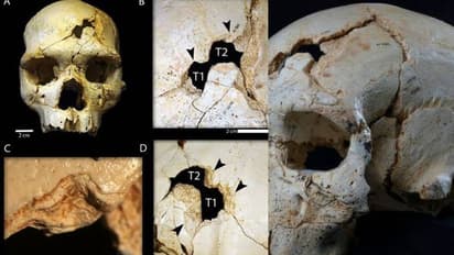 ലോകത്തിലെ ആദ്യത്തെ കൊലപാതകം നടന്നത് 430,000 വർഷങ്ങൾക്ക് മുമ്പ്? 