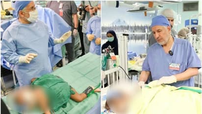 രണ്ടാണെങ്കിലും നമ്മളൊന്നല്ലേ; ഒമ്പത് ഘട്ടങ്ങൾ, പതിനാറര മണിക്കൂര് നീണ്ട ശസ്ത്രക്രിയ, ഹസ്നയും ഹസീനയും രണ്ടായി