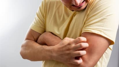 ലിവർ സിറോസിസിന്റെ ഈ പത്ത് ലക്ഷണങ്ങളെ ഒരിക്കലും അവഗണിക്കരുത്...