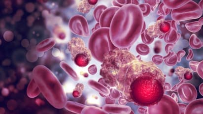 ബ്ലഡ് ക്യാൻസർ; ഈ  പ്രാരംഭ ലക്ഷണങ്ങളെ അവഗണിക്കരുതേ... 