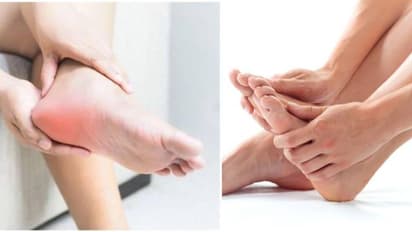  Plantar fasciitis: एड़ी में दर्द का ये है सबसे बड़ा कारण, डॉक्टर के बताए इन तरीकों से पा सकते हैं राहत