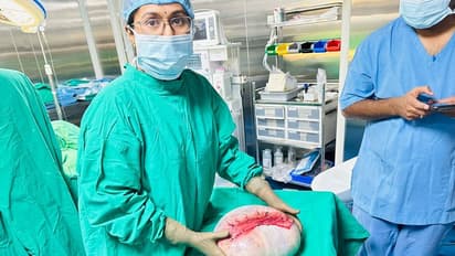 ಯುವತಿಯ ಹೊಟ್ಟೆಯಲ್ಲಿ 7.5 ಕೆಜಿ ಗಡ್ಡೆ: ಕ್ಯಾನ್ಸ್ ಮಲ್ಟಿಸ್ಪೆಷಾಲಿಟಿ ಆಸ್ಪತ್ರೆ ವೈದ್ಯರಿಂದ ಯಶಸ್ವಿ ಶಸ್ತ್ರಚಿಕಿತ್ಸೆ