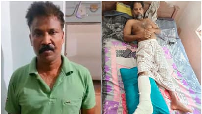 മദ്യം കിട്ടും, പറഞ്ഞ് വിട്ടത് മദ്യവിരുദ്ധ സമിതി ചെയർമാന്റെ വീട്ടിലേക്ക്; 'സാധനം' കിട്ടാത്തതിന് കാൽ ഒടിച്ചു
