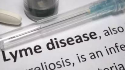 എറണാകുളത്ത് അപൂർവരോഗം റിപ്പോർട്ട് ചെയ്തു, ലൈം രോഗത്തിന്‍റെ ഈ ലക്ഷണങ്ങളെ അറിഞ്ഞിരിക്കാം... 